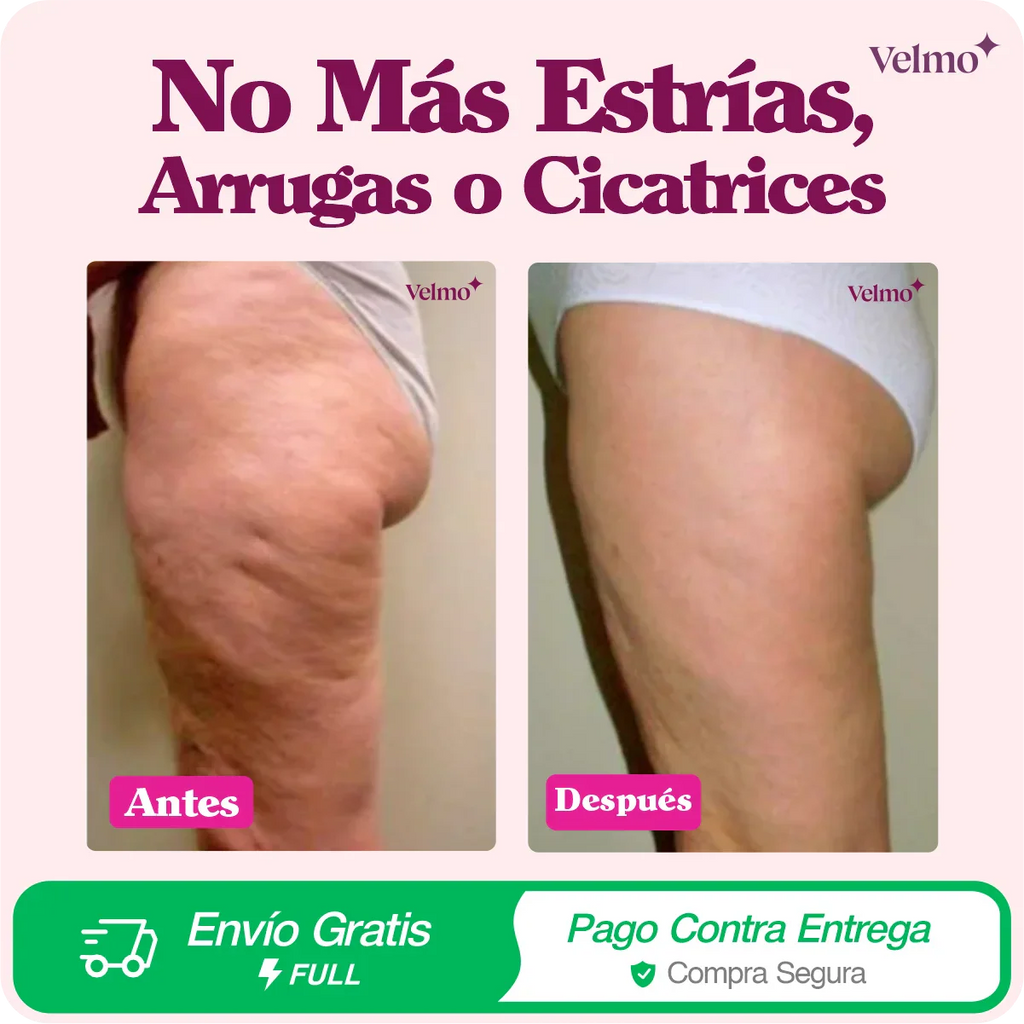 Crema ADEUS Rosa | Anti Estrías